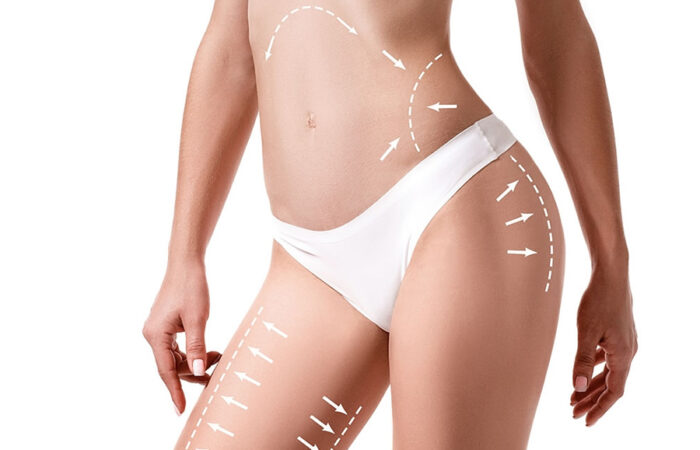 Yaza Fit Girmek İçin Geç Değil: 30 Günde Bölgesel İncelme İçin Yol Haritası