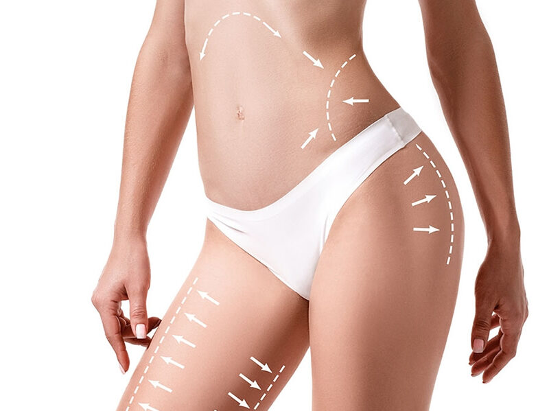 Yaza Fit Girmek İçin Geç Değil: 30 Günde Bölgesel İncelme İçin Yol Haritası