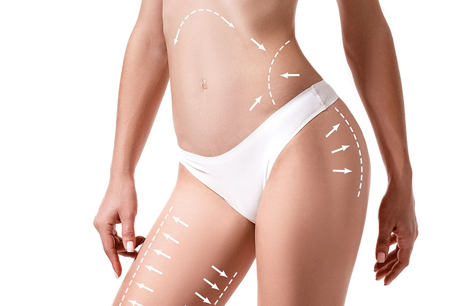 Yaza Fit Girmek İçin Geç Değil: 30 Günde Bölgesel İncelme İçin Yol Haritası