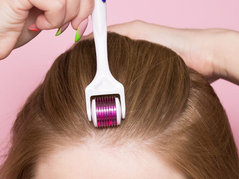 Saç Dökülmesine Karşı Dermapen