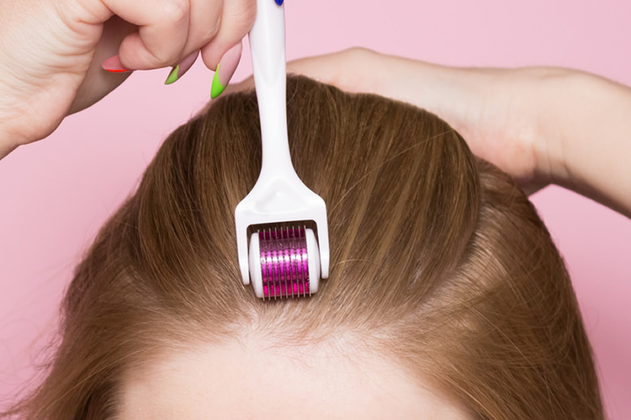 Saç Dökülmesine Karşı Dermapen